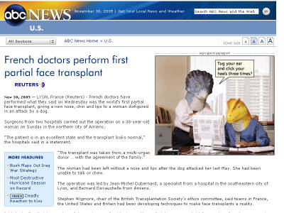 Screen capture of ABC News face transplant article scaled to 400 x 300 and lossily compressed with JPEG.